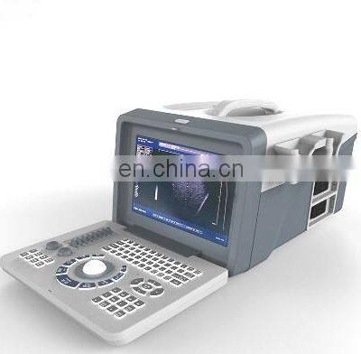 factory price china portable pregnancy diagnosis black and white  ultrasound scanner  machine