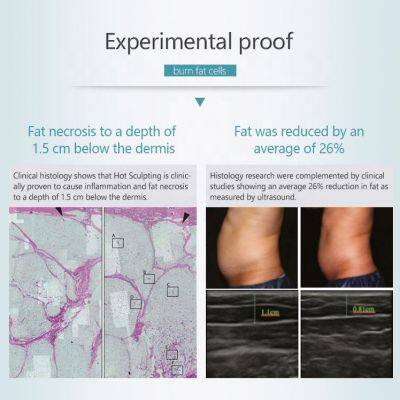 Trusculpt Id and Flex Inmode Tite Body Slimming Double Chin Cutera Evolve Tite Bipolar Rf Slimming 3d Trusculpt Id photo-6