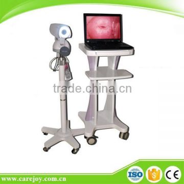 LED Gynaecology video colposcope price in China RCS-500