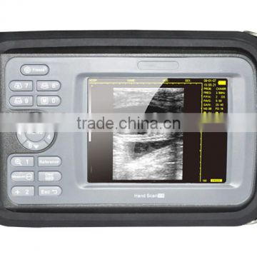 Factory price!!CE approved Notebook/ Handheld Ultrasound Scanner with transvaginal probe H8