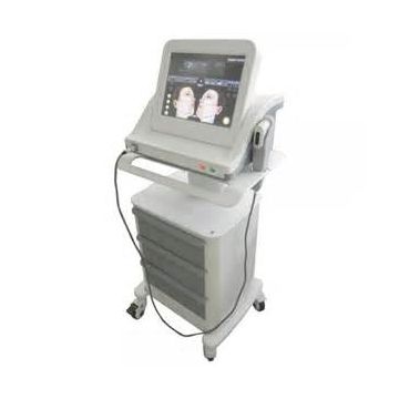 High Frequency Skin Machine Nasolabial Folds Removal High Intensity Focused Ultrasound Forehead Wrinkle Removal 0.2-3.0j