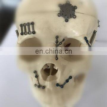 Skull Titanium Mesh,Pure Titanium Preformed Orbital Plate, Small, Right, 0.4mm Thick photo-2