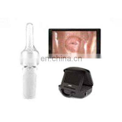 Wholesale Digital Video Vaginal Self-Exam Mini Colposcope for Home Use photo-4