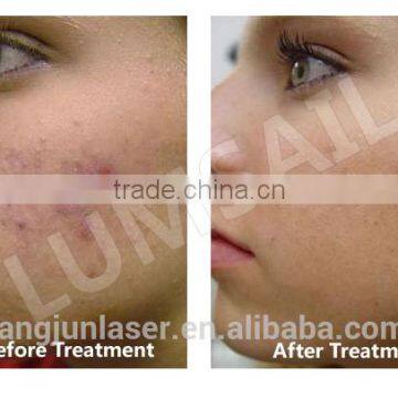Photodynamic LED Skin Care LED Phototherapy Equipment for Sale photo-6