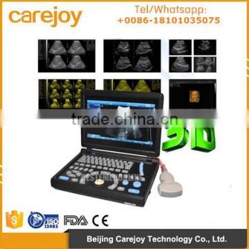 Best selling Laptop Ultrasound machine/Scanner with convex linear intracavity endocavity endo vaginal probe