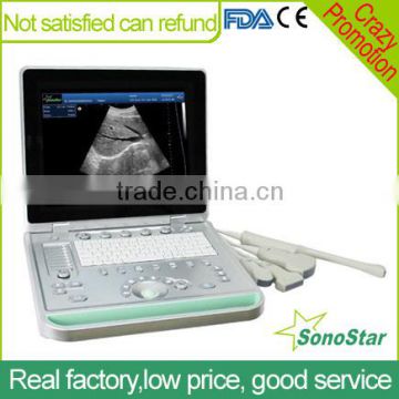 Sonostar hospital veterinary equipment B model ultrasound machine for sale V9