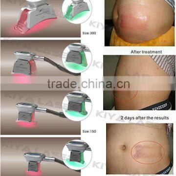 Most Popular Slimming! Cool Lipo Machine photo-3