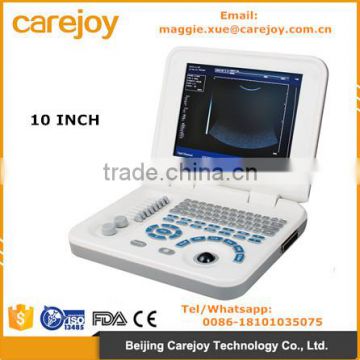 Carejoy laptop Ultrasound Machine Ultrasound Scanner with convex probe RUS-9000F2 by CE ISO approved