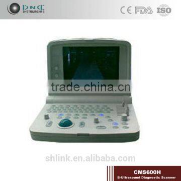 hotsale shanghai link best CMS280C Mobile hospital instrument Ultrasound Scanner