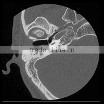 Medical blue sensitive x-ray film