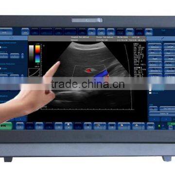 Medical color doppler Ultrasound Diagnostic System, color doppler ultrasound