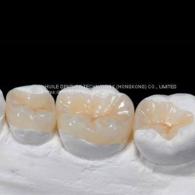 Full Service China Dental Lab Outsourcing of Metal Framework Cobalt Chromlum photo-2