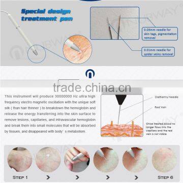 Professional Remove Varicose Veins Machine for Sale photo-2