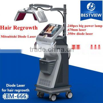 Bestview Diode Laser help you hair regrowth Quickly laser hair regrowth