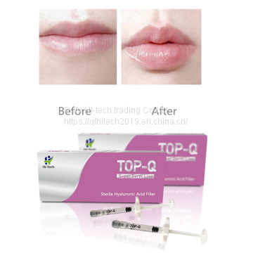 TOP-Q 2ml Safety Hyaluronic Acid Gel Dermal Filler for Increase Skin Hydration