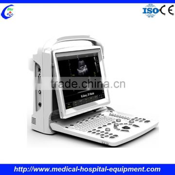 Portable Color Doppler Ultrasound Scanner