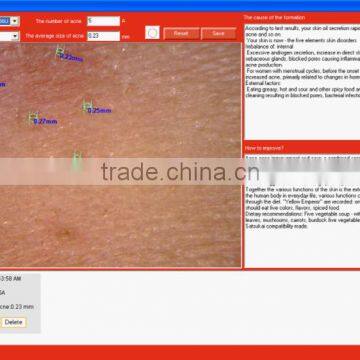 Professional Clinic Use Face Skin Analysis Equipment With FCC/CE Approval photo-3