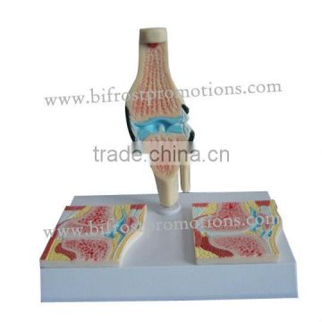 Knee Skeleton Model, Medical Teaching Model