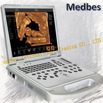 3D Laptop Pregnancy Test Ultrasound Diagnostic Scanner Laptop Ultrasound Scanner