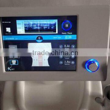 HIFU Therapy High Intensity Focused Therapeutic Ultrasound photo-2