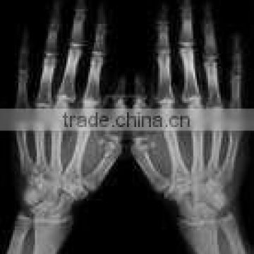 wholesale x-ray medical film, digital radiography film,digital dry film made in china