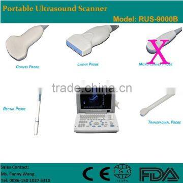CE Approved Laptop/Portable Ultrasound Scanner With 3.5Mhz Multi-frequency Convex Probe RUS-9000B photo-2