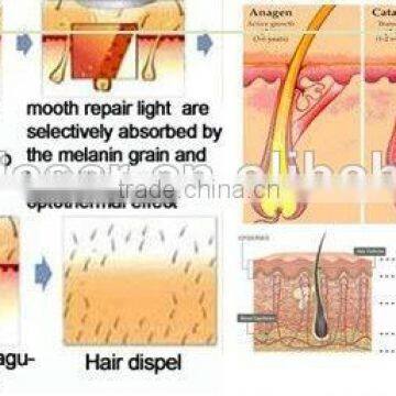 Newest Skin Tightening Face Lifting RF Machine photo-4