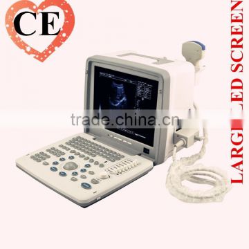 2016 Large Screen LED Clear Image Full Digital Portable ultrasounic Scanner Machine System with 2 probe connector