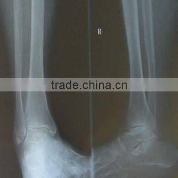 China equipo de rayos x KND-A/F CE