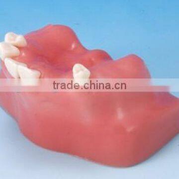 Factory price clinical drill model cableway/ dental implant model/implantes for teeth