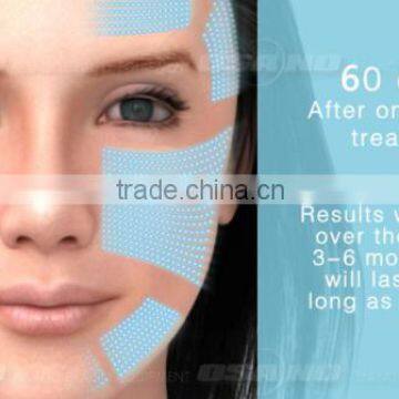 Osano LM-S809A High Frequency Operation System Slimming Hifu Machine photo-6