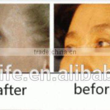 NL-M400 Premium Microcurrent Skin Tightening Skin Rejuvenation Mesotherapy Gun Beauty Device photo-6