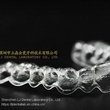 Clear aligners, invisalign, teeth aligner, dental brace, laboratoire dentaire, Dentallabor, laboratorio dental, dental laboratory, Shenzhen LJ dental lab China