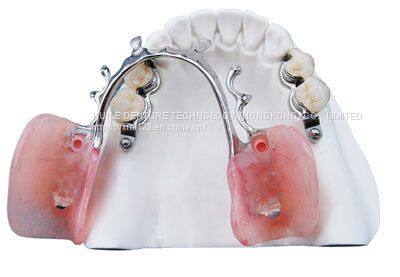 dental laboratory false teeth Chrome Cobalt titanium 3d metal printed partial dentures