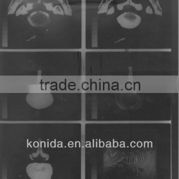 x ray films in china,x ray fuji film,x ray medical imaging film