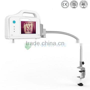 YSVV200 Guanghzou Hot Vein Illumination Device Price photo-2