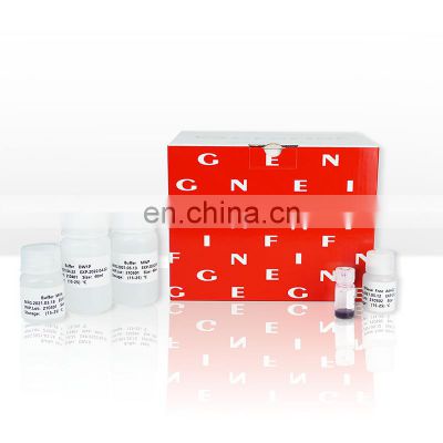 Medical Equipment Nucleic Acid Extraction Reagent Buffer Without Proteinase K