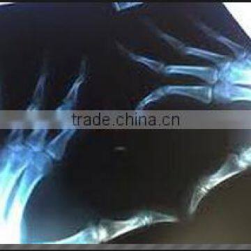 Konida fuji medical x-ray dry film thermal for sale hot sex film