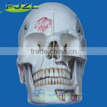 10 parts of realistic Dental Neurology skull model/dental educational skulls