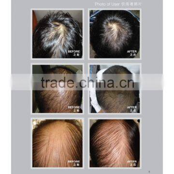 Meinas Bionutri Food (For Hair Regrowth) photo-4