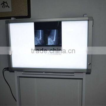 LED Medical X-ray Illuminator photo-2