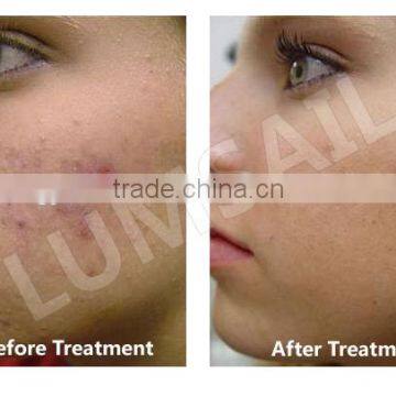 Colorful LED Phototherapy Light Therapy Facial Skin Spa Equipment photo-2