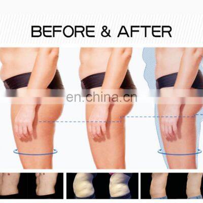 Ems Latest High-Intensity Focused Electromagnetic Deep Muscle Stimulate Machine photo-5