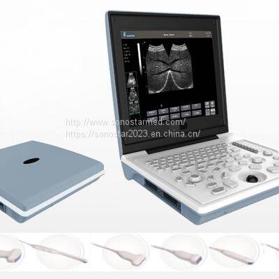 SS-6B Laptop All-Digital Ultrasound photo-3