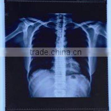 Dry thermal medical X-ray film for hospital agfa laser film fuji used in hospital from china medical equipments