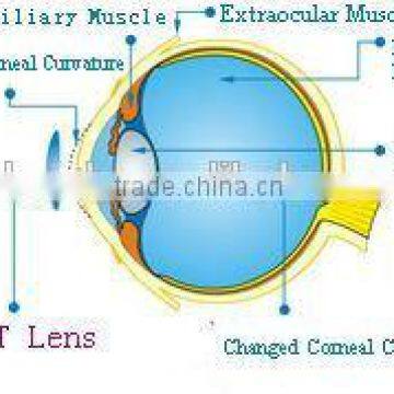 For low myopia MCT Technology high technology