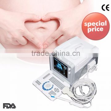 2015 new Digital Portable Ultrasound Scanner