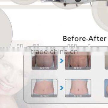 Lipolaser Slimming Machine photo-2