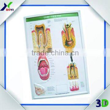 3D Plastic Medical Wall Posters, Customized 3D Anatomical Charts photo-3