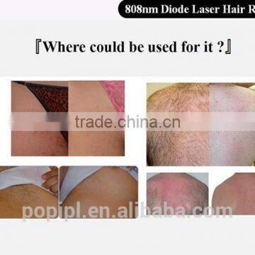 Top Quality Best Performance Convenient Laser Hair Removal DL7 photo-5